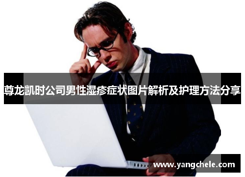 尊龙凯时公司男性湿疹症状图片解析及护理方法分享